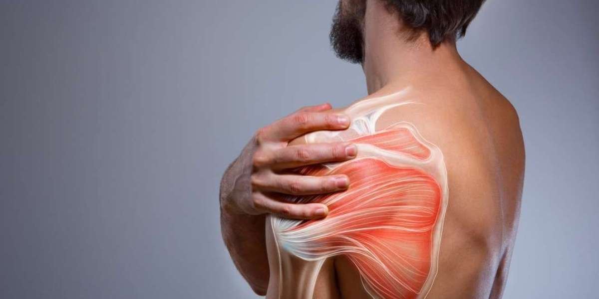 Shoulder Pain Treatment Dubai Using Dry Needling